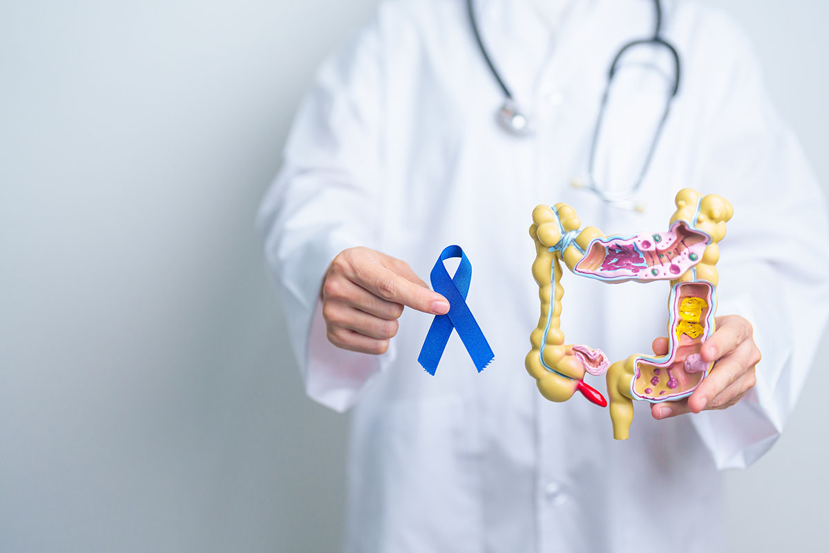 From Awareness to Action: Navigating Colon Cancer Screenings for Men’s Health