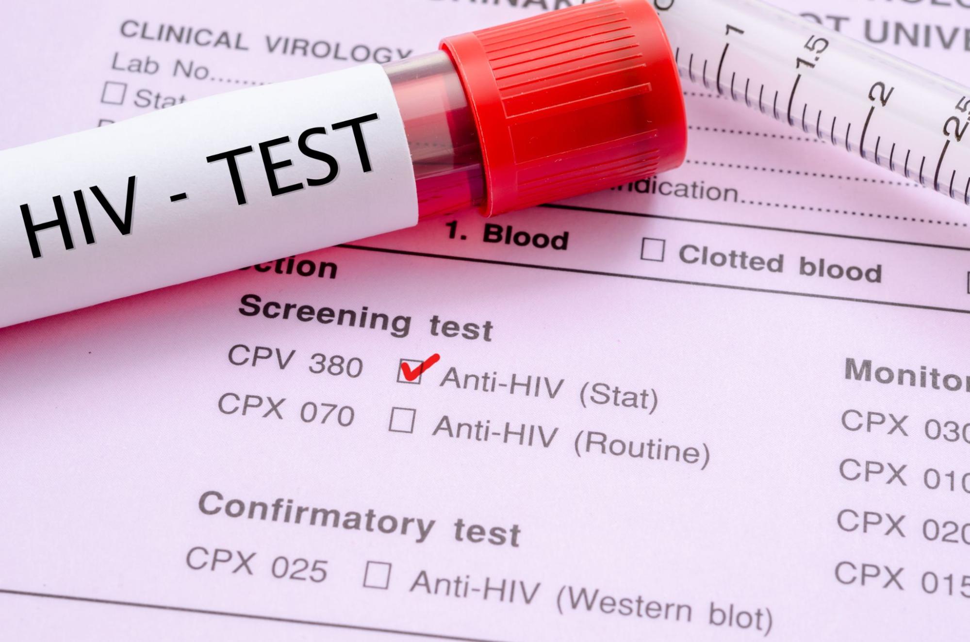 HIV Symptoms: What to Watch for and When to Get Tested